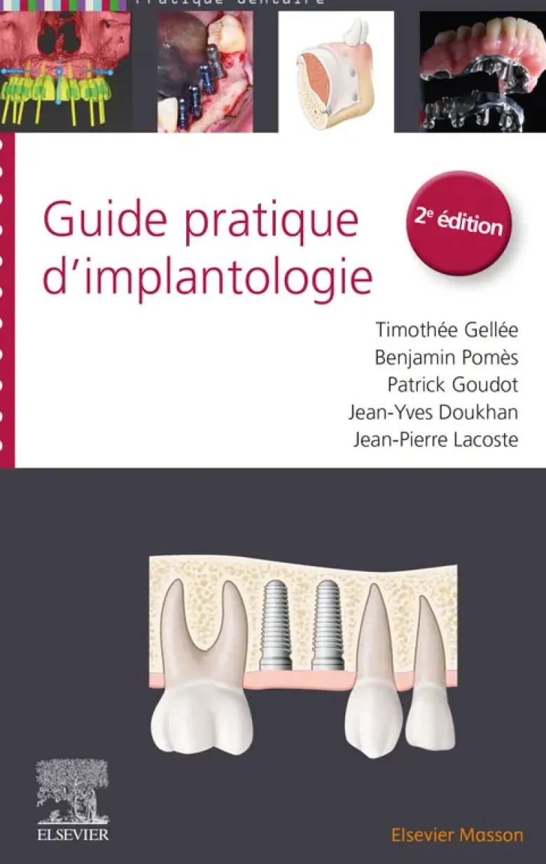 Guide pratique d'implantologie