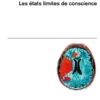 Un Si Brillant Cerveau
